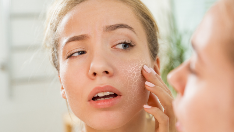 Tips: verzorging gevoelige huid
